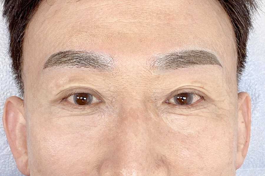 After