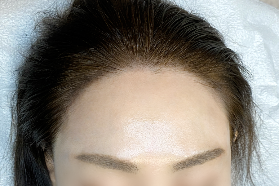 After