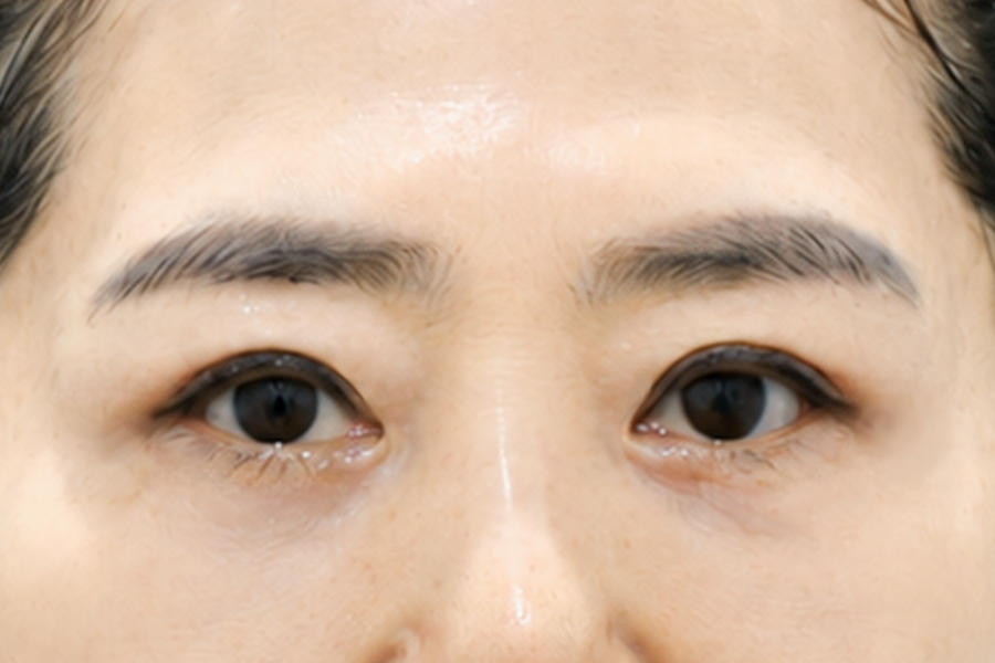 After