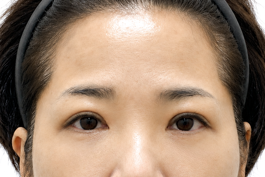 After