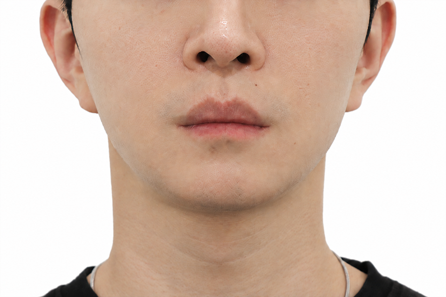 After