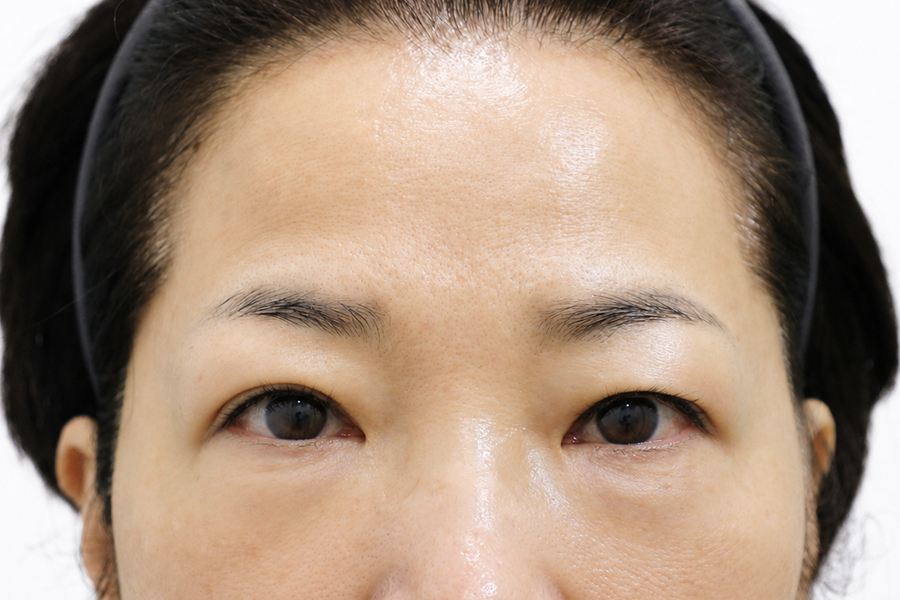 Before