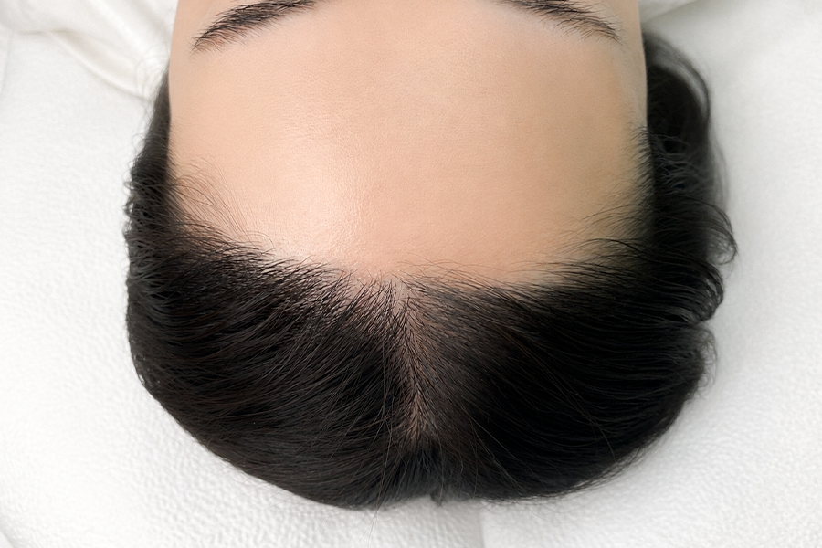 Before