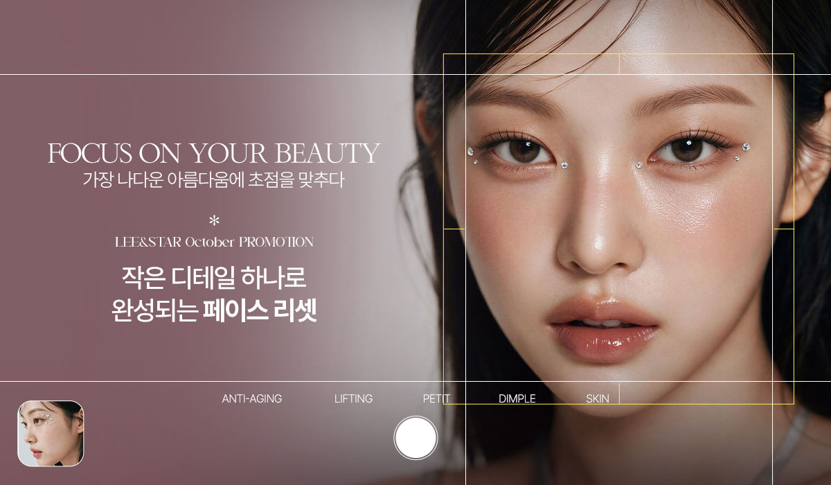 미모 리셋, 특별전